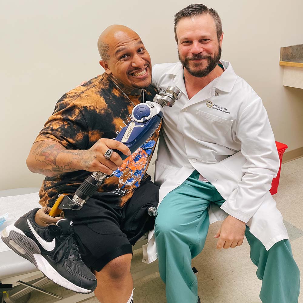 University Colorado Osseointegration Prosthetic Stoneback Limb Restoration