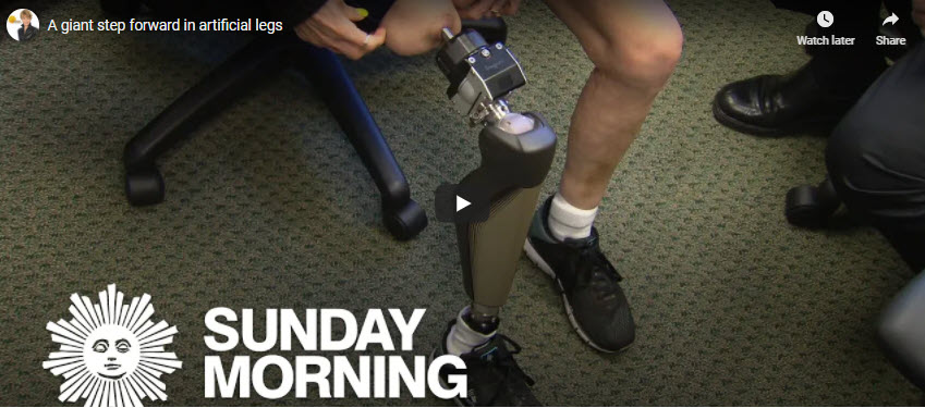 A Giant Step Forward in Artificial Legs, Dr. Jason Stoneback