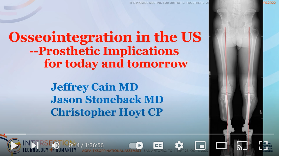 Osseointegration in the US--Prosthetic Implications for today and tomorrow