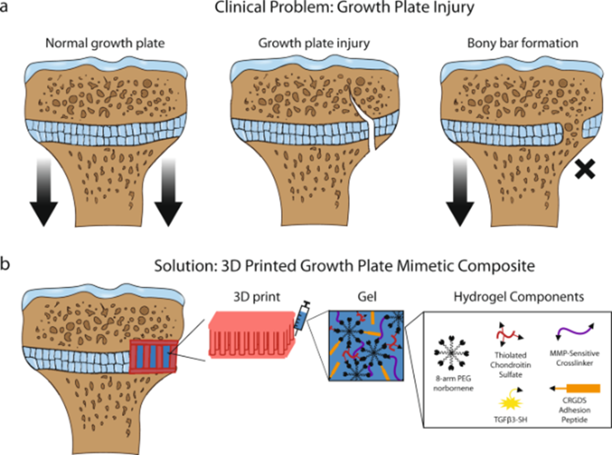 Clinical Problem: Growth Plate Injury