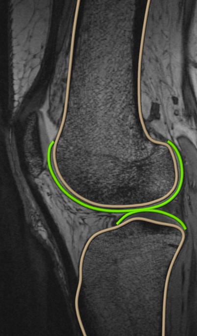 Development of chondroregenerative therapy for osteoarthritis
