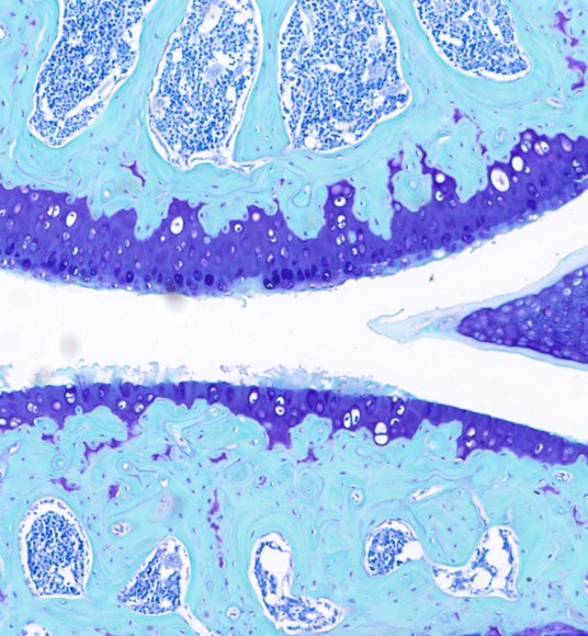 Role of the gut microbiome in osteoarthritis