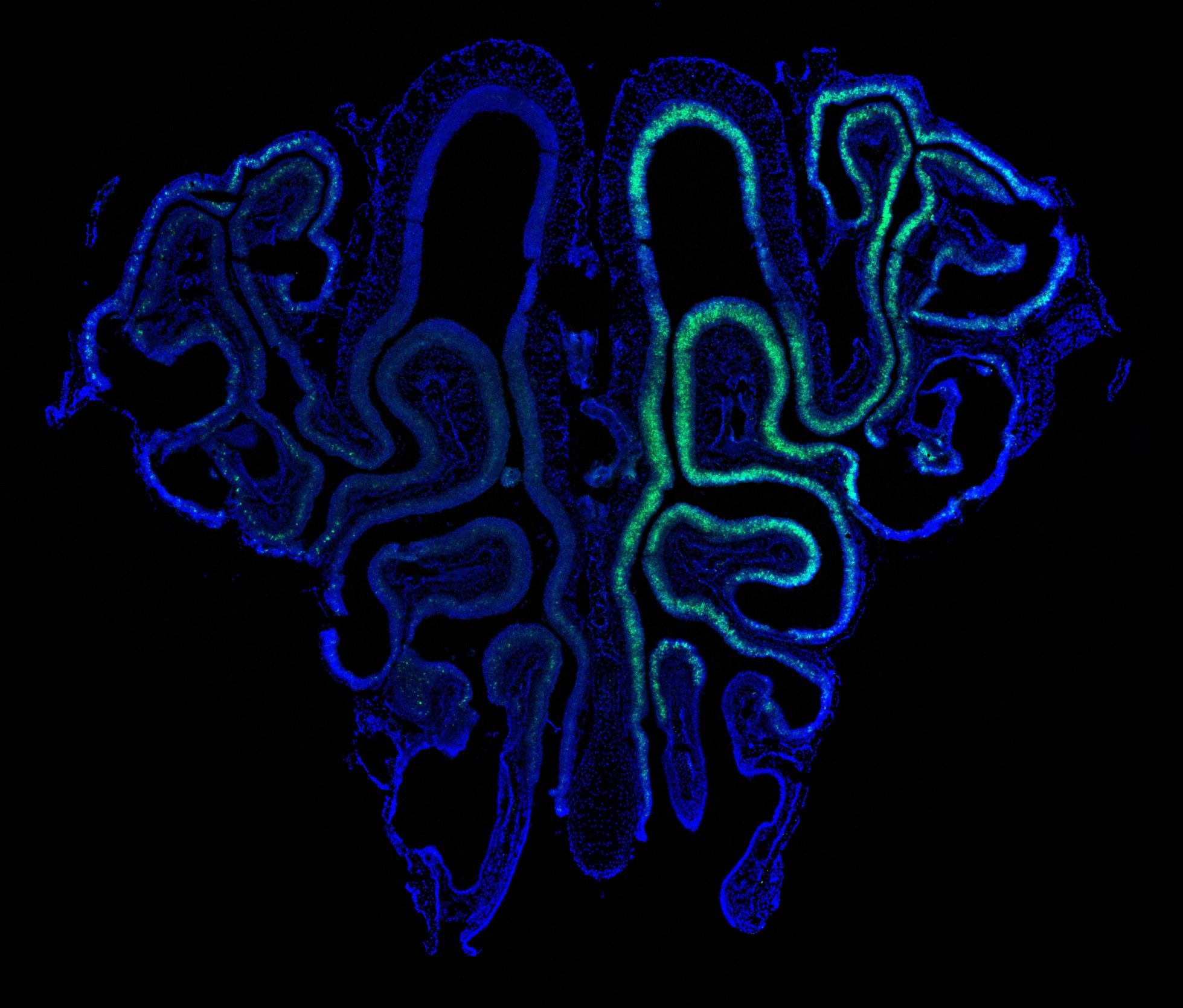 S100a5 staining in the olfactory epithelium by Karlin Rufenacht