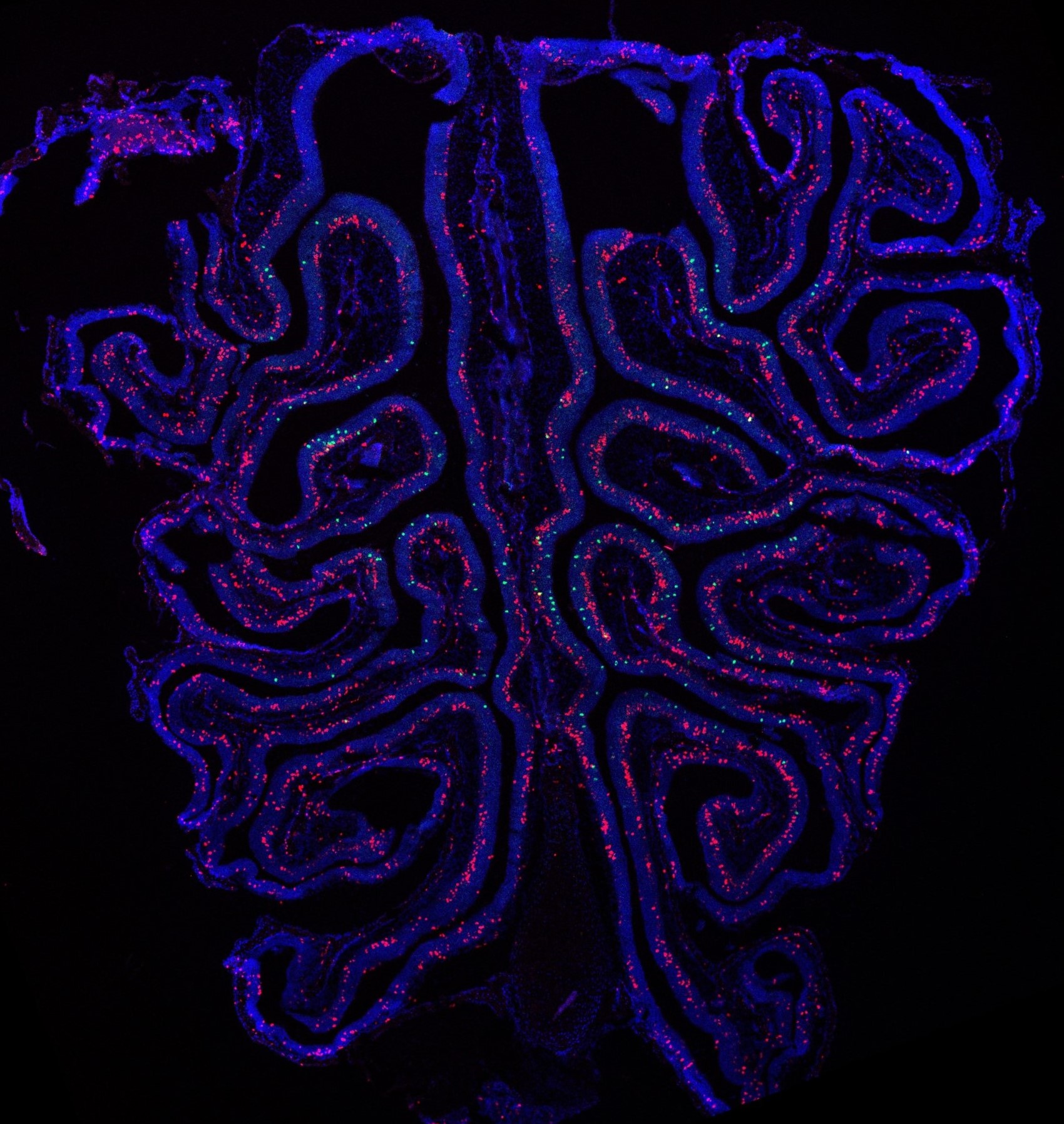 olfactory receptors in the olfactory epithelium