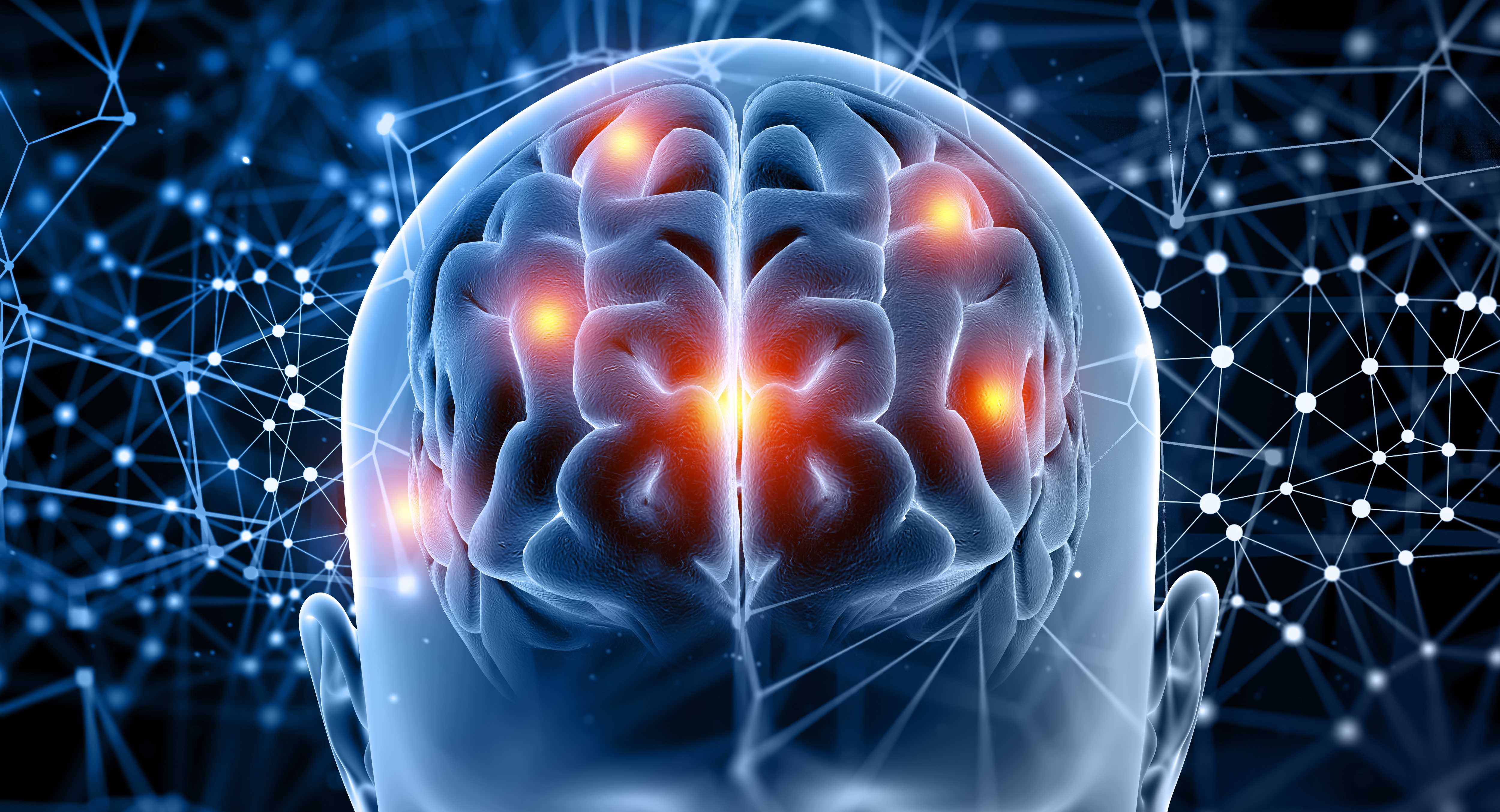 CBI-M Brain