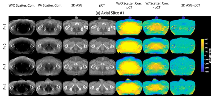 Fig_protonCBCT Fig_protonCBCT