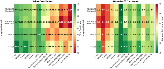 Figure_DLSegmentation Figure_DLSegmentation