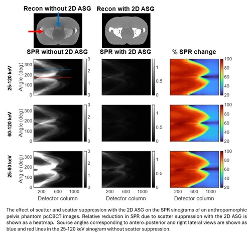 ScatterSinogram ScatterSinogram