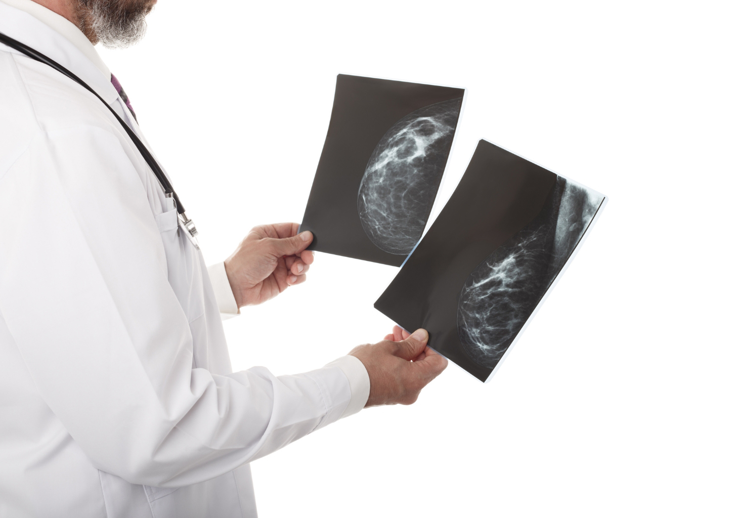 Breast Cancer Imaging