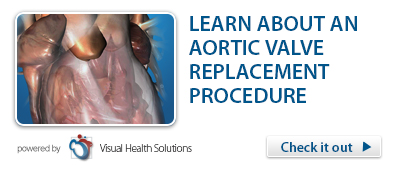 Video -- Aortic Valve Replacement