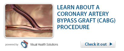 Video -- Coronary Artery Bypass Graft (CABG)