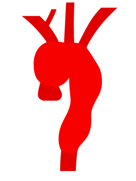 Aortic arch