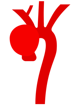 Aortic Root & Ascending Aorta