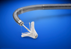 MitraClip Mitral Valve Repair