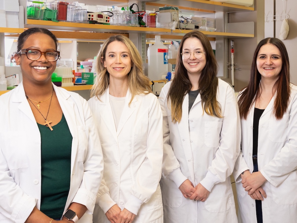 Kim Bruce Alzheimers Research