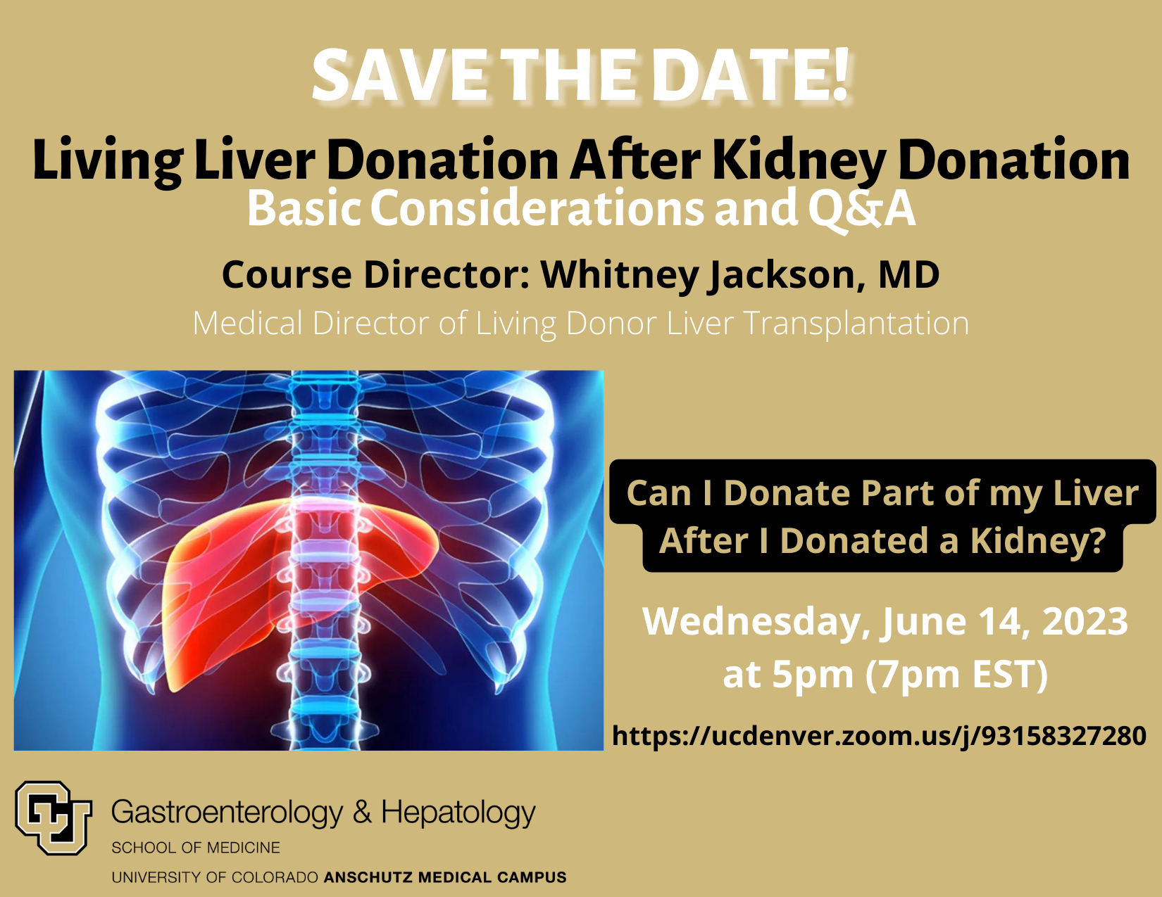 living-liver-donation-patient-education