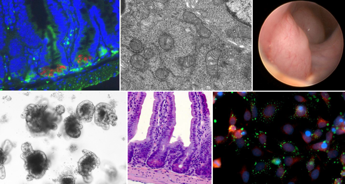 Colon Tumor, Epithelial Mitochondria, H&E Ileum, Immunoflourescence, Intestinal Organoids, RKO IF