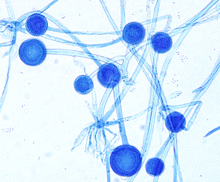 Drawing of infectious agents