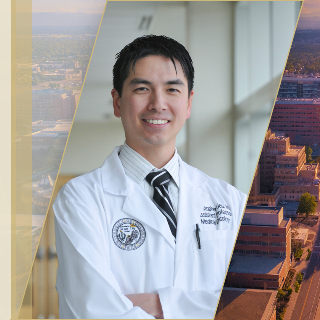 Chris Lieu GI