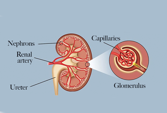 glomerural-kidney-injury