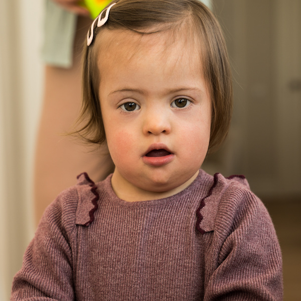 Image of toddler aged girl with Down syndrome