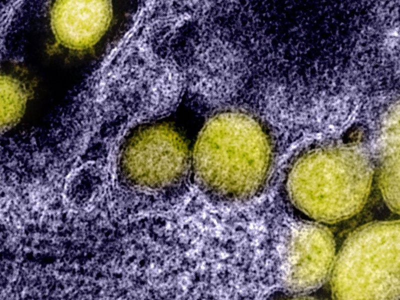 Electron microscope image of the sars-cov-2 virus