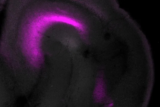 Viral Tracing